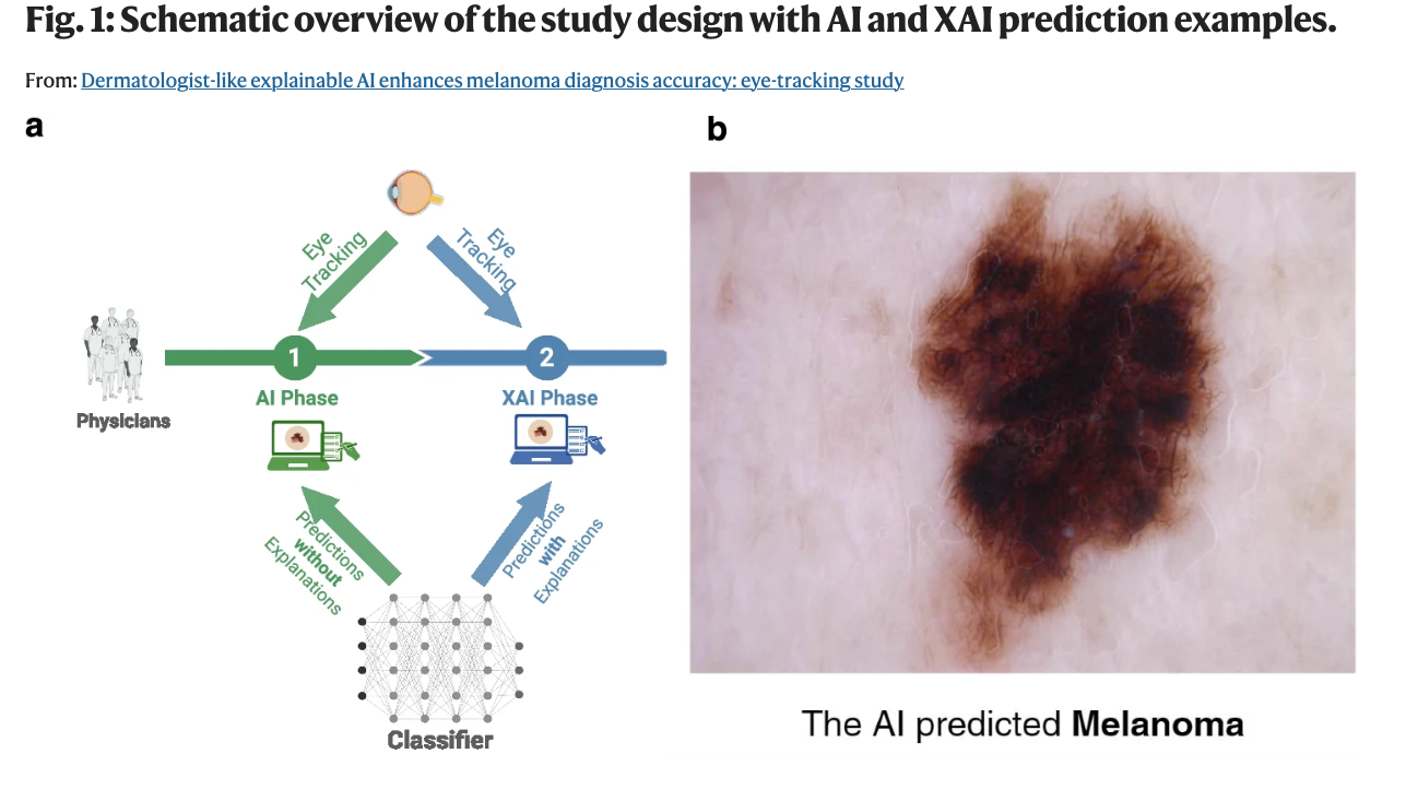 AI-powered medical imaging analysis showing tumor detection